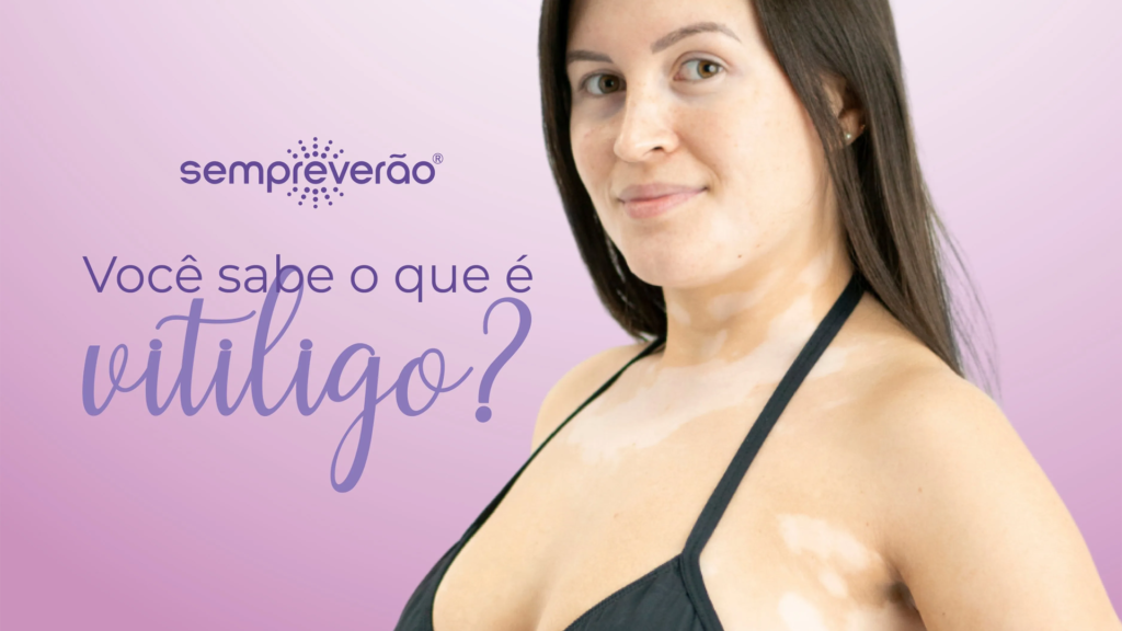 O que é Vitiligo?